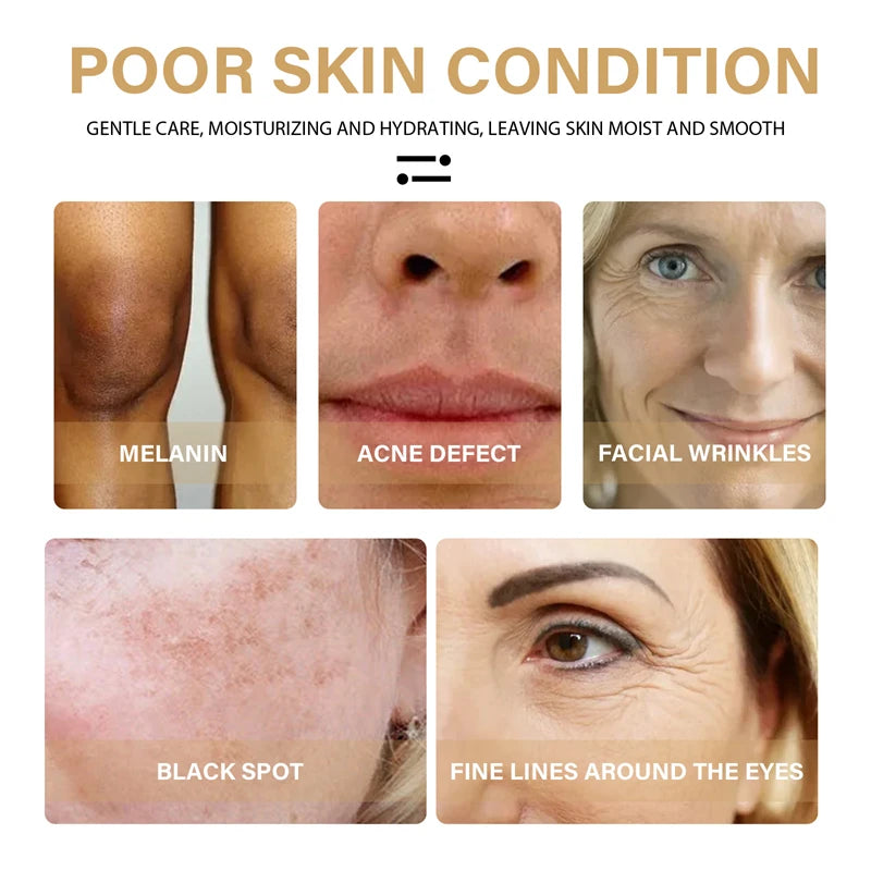 Sérum pour le visage au curcuma, rétrécit les pores, Essence réparatrice, mélanine, éclaircissant, hydratant, nourrissant, huile de cur-cumin, estompe les taches foncées, soins pour la peau