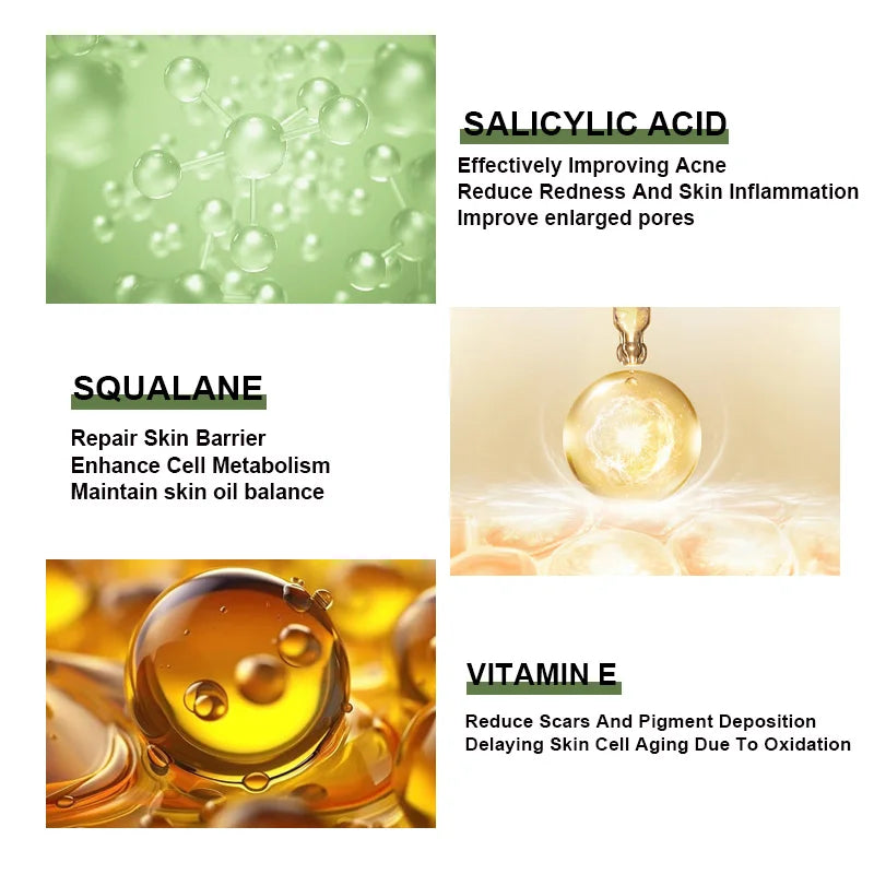 Sérum anti-acné coréen pour le visage, acide salicVAC, essence remodelée, squalane, vitamine E, hydratant, éclaircissant, produits de soin de la peau