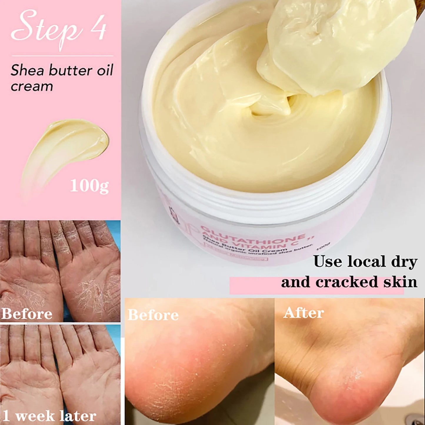 AILKE-Crème hydratante blanchissante pour le visage, élimine les taches noires, soins de la peau du visage, gratitude, corps, glutathion, vitamine C, peau noire, nouvel ensemble