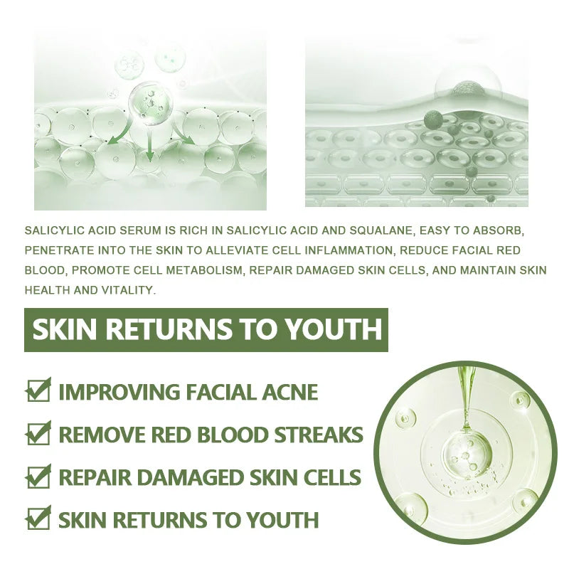 Sérum anti-acné coréen pour le visage, acide salicVAC, essence remodelée, squalane, vitamine E, hydratant, éclaircissant, produits de soin de la peau
